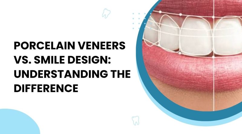 smile design doctor in Vaishali Nagar
