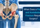 When Does a Pelvic and Acetabulum Fracture Require Surgery?