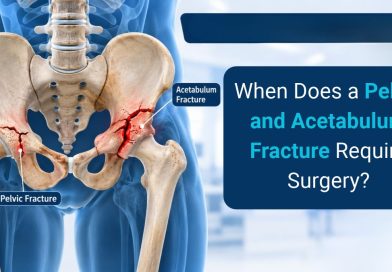 When Does a Pelvic and Acetabulum Fracture Require Surgery?