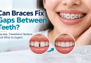Can braces fix gaps between teeth with orthodontic treatment?